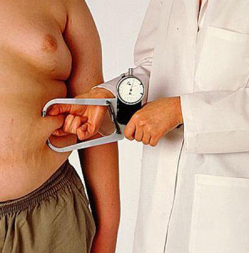 Hội tim Hoa Kỳ cảnh bảo mức độ nguy hiểm trong phẫu thuật ở người béo phì 1