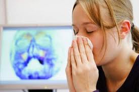 Triệu chứng và cách phòng ngừa bệnh viêm xoang mũi 1