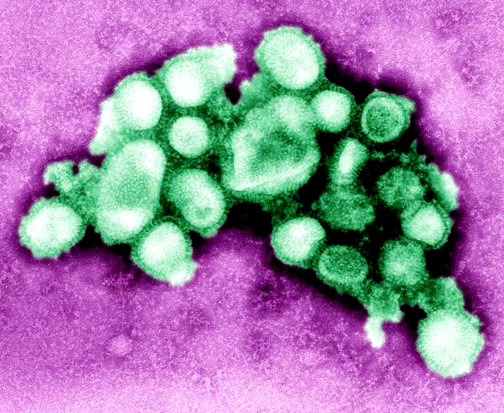 Thời tiết lạnh cảnh giác với dịch cúm A/H1N1 1