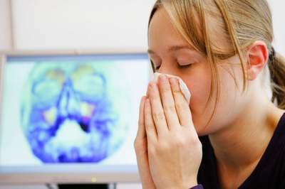 Bệnh viêm xoang mũi - Nguyên nhân và cách xử trí 1