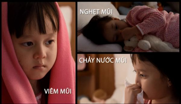 Những dấu hiêu, triệu chứng của viêm mũi trẻ em 1