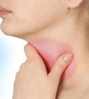 Nguyên nhân gây đau họng và cách phòng trị hiệu quả 1