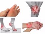 Nhức mỏi chân tay là bệnh gì? Nhức mỏi chân tay là bệnh gì?