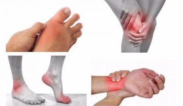 Nhức mỏi chân tay là bệnh gì? Nhức mỏi chân tay là bệnh gì?