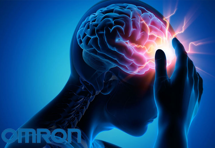 Rối loạn tuần hoàn não là gì? 1