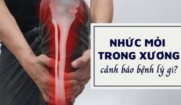 Nhức mỏi trong xương cảnh báo bệnh lý gì? Nhức mỏi trong xương cảnh báo bệnh lý gì?