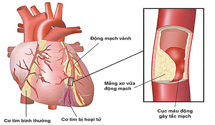 Một số bệnh lý khác 1